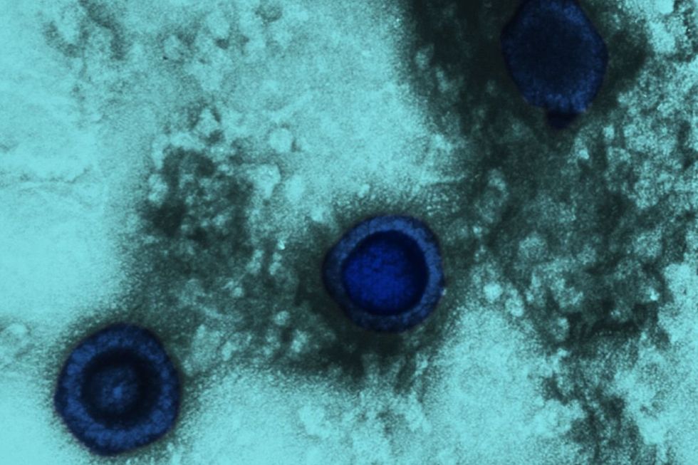 \u200bHERPES UNDER MICROSCOPE