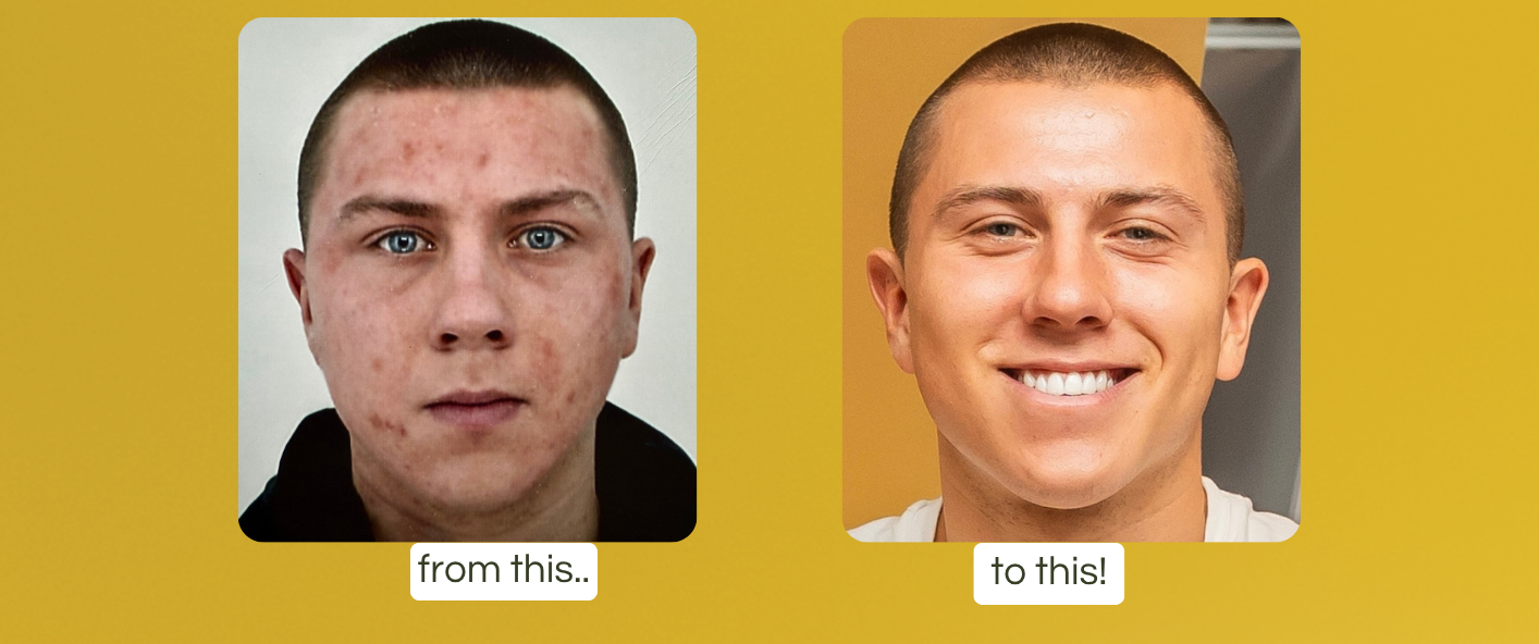 \u200bR12 Botanicals