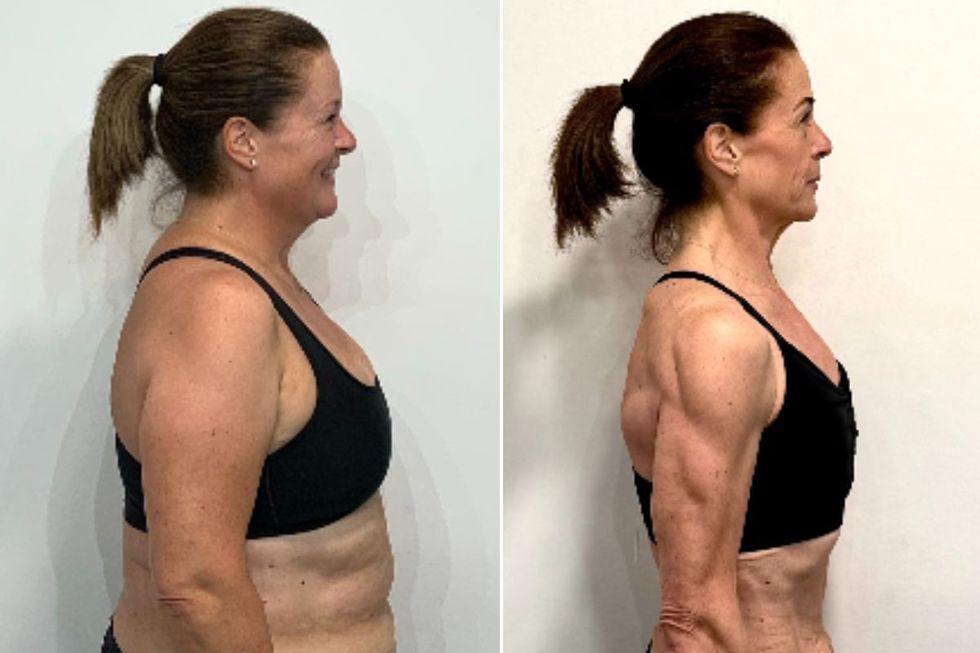 \u200bSamantha MacKenzie before and after