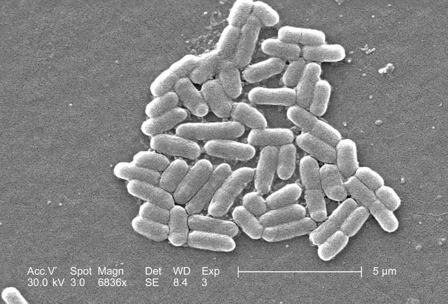 \u200bScientists observed the E Coli micro-organism