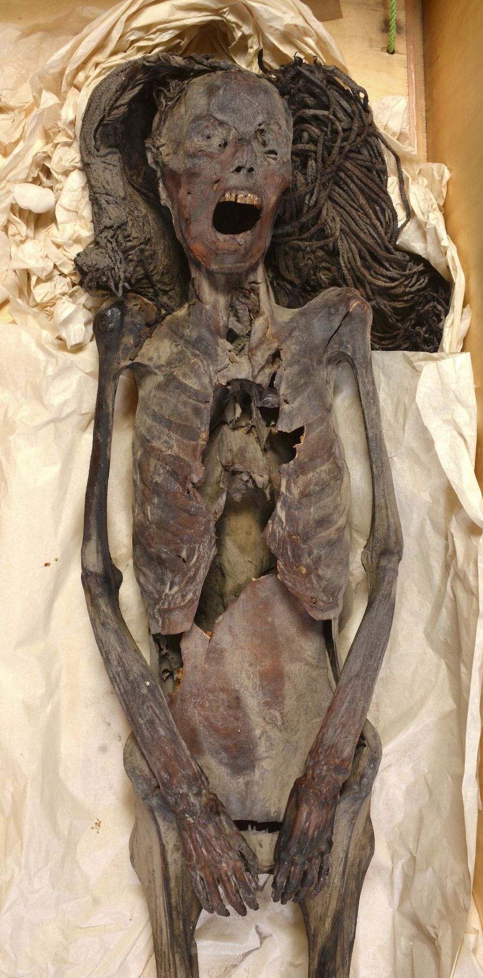 \u200bThe "Screaming Woman" mummy, discovered in 1935 at Deir Elbahari near Luxor and dating to about 1500 BC