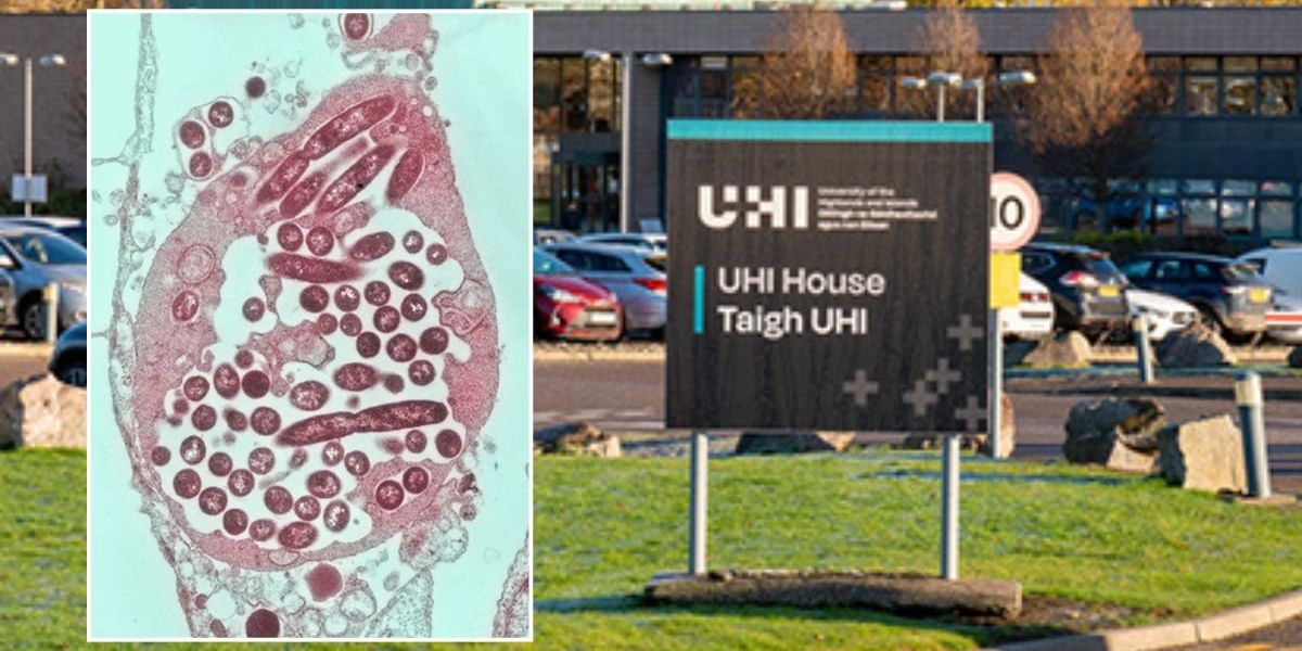 Inverness Legionella outbreak: Dozens of NHS appointments cancelled after deadly bacteria scare Inverness Legionella outbreak: Dozens of NHS appointments cancelled after deadly bacteria scare