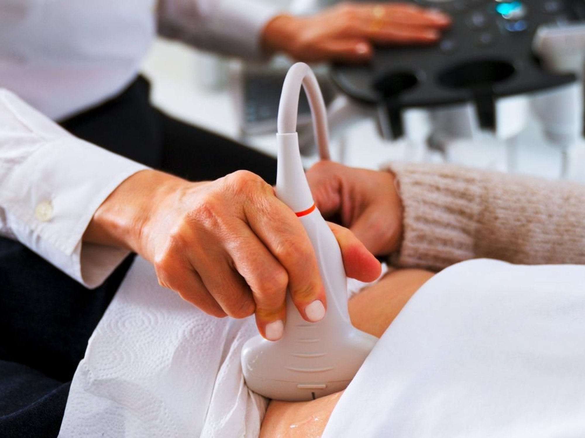 ULTRASOUND SCAN ON WOMAN