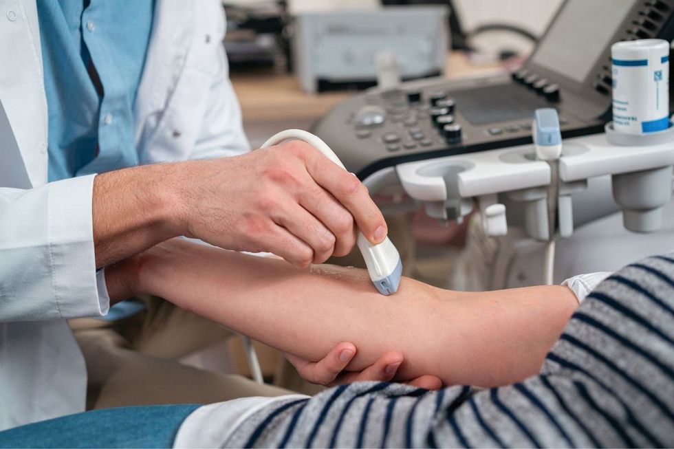 ULTRASOUND TO CHECK BLOOD VESSELS