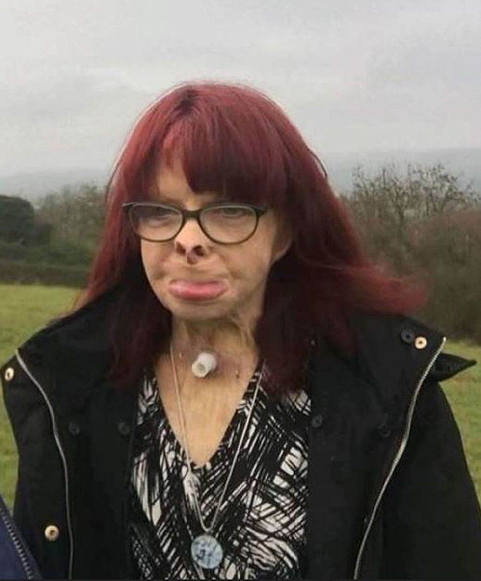 Undated handout photo issued by Avon and Somerset Police of Jacqueline Kirk. Steven Craig is due to be sentenced Bristol Crown Court for murdering his partner - who died 21 years after he doused her with petrol and set her on fire. The 58-year-old inflicted horrendous injuries on Kirk in a car park in Weston-super-Mare, Somerset, in April 1998. Issue date: Thursday November 10, 2022.