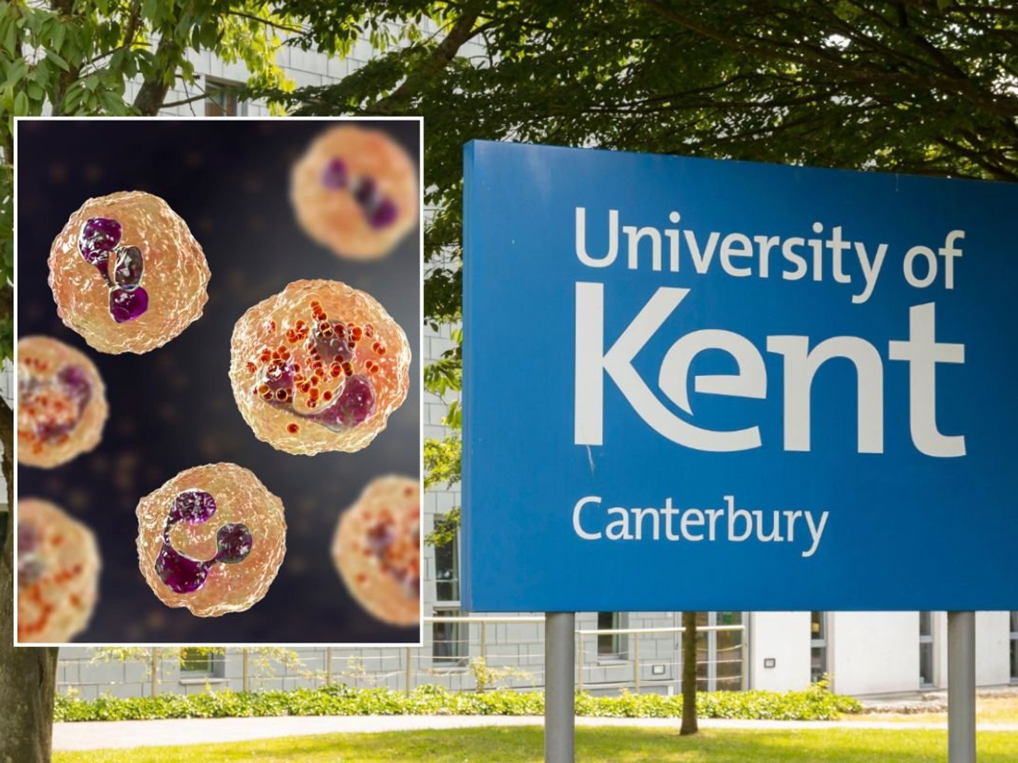 UNIVERSITY OF KENT