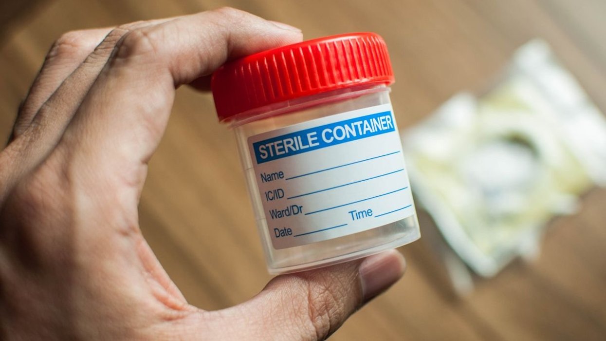 URINE TEST SAMPLE
