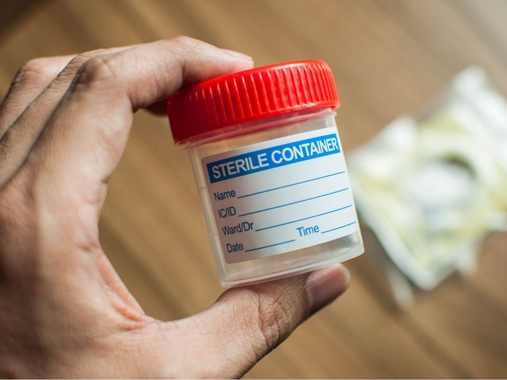 URINE TEST SAMPLE