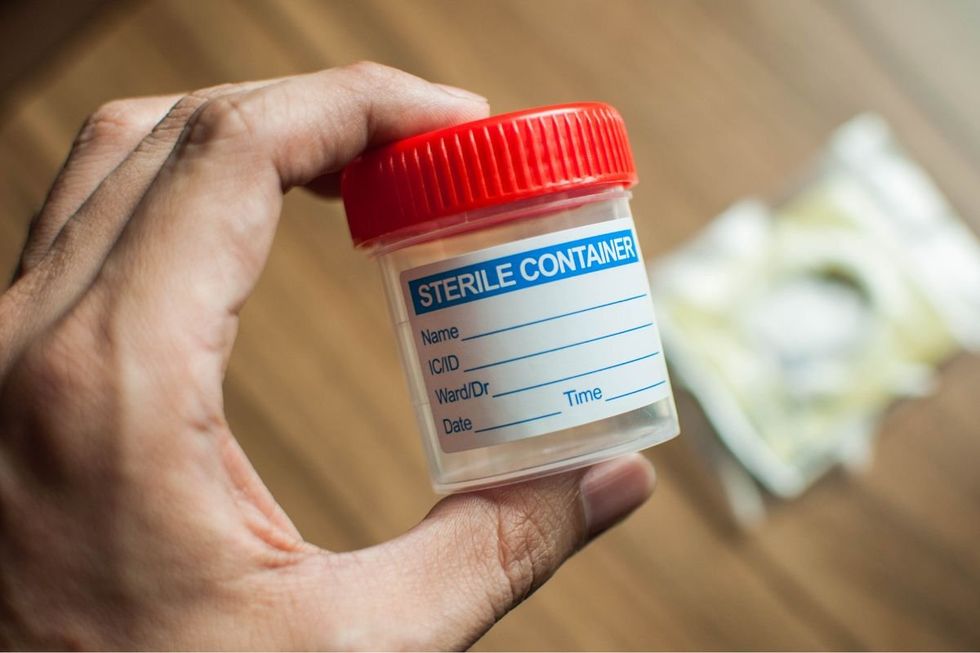 URINE TEST SAMPLE