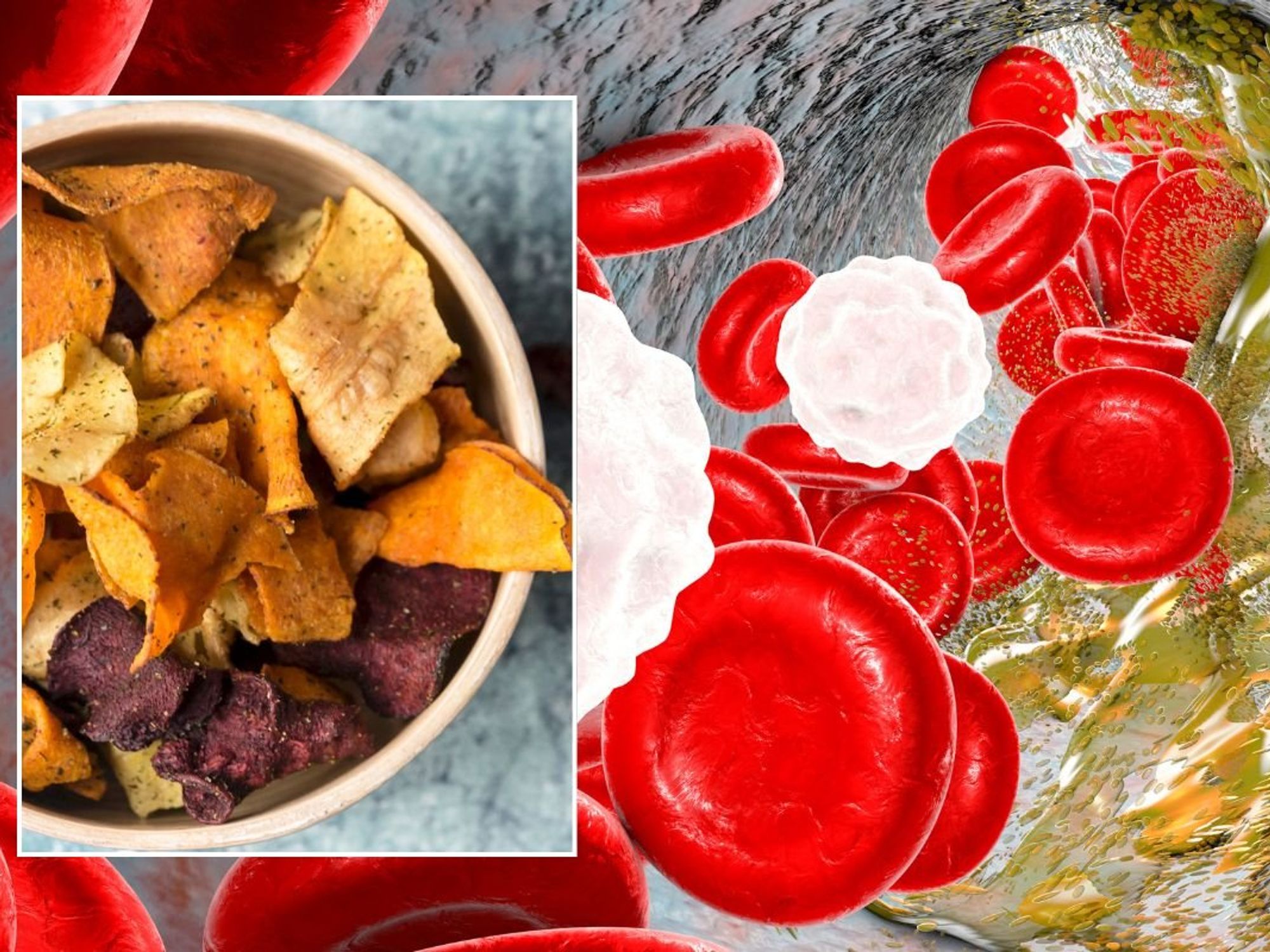 VEGETABLE CRISPS AND CHOLESTEROL