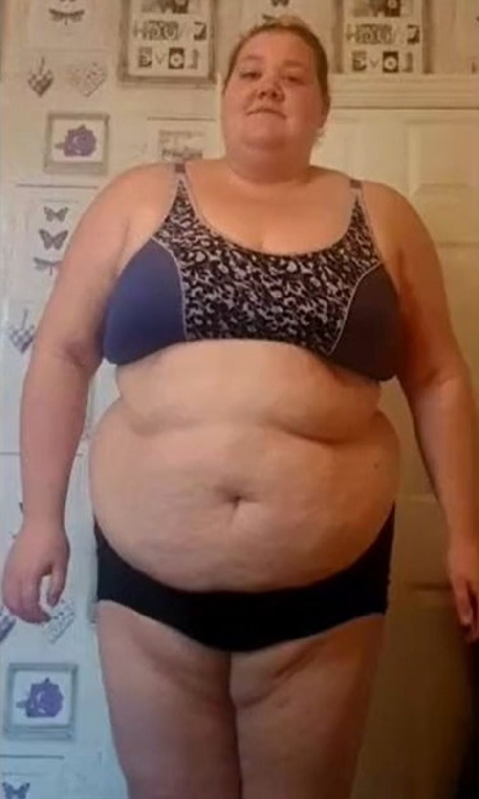 vikki before and after pictures