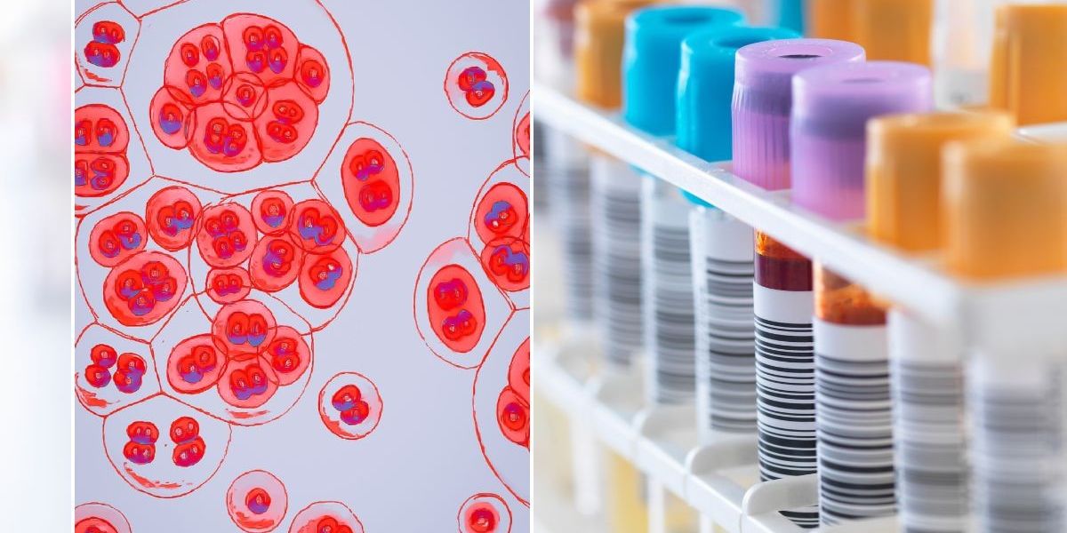 NextImg:HIV breakthrough as scientists make crucial step towards cure - 'Never seen anything as good'
