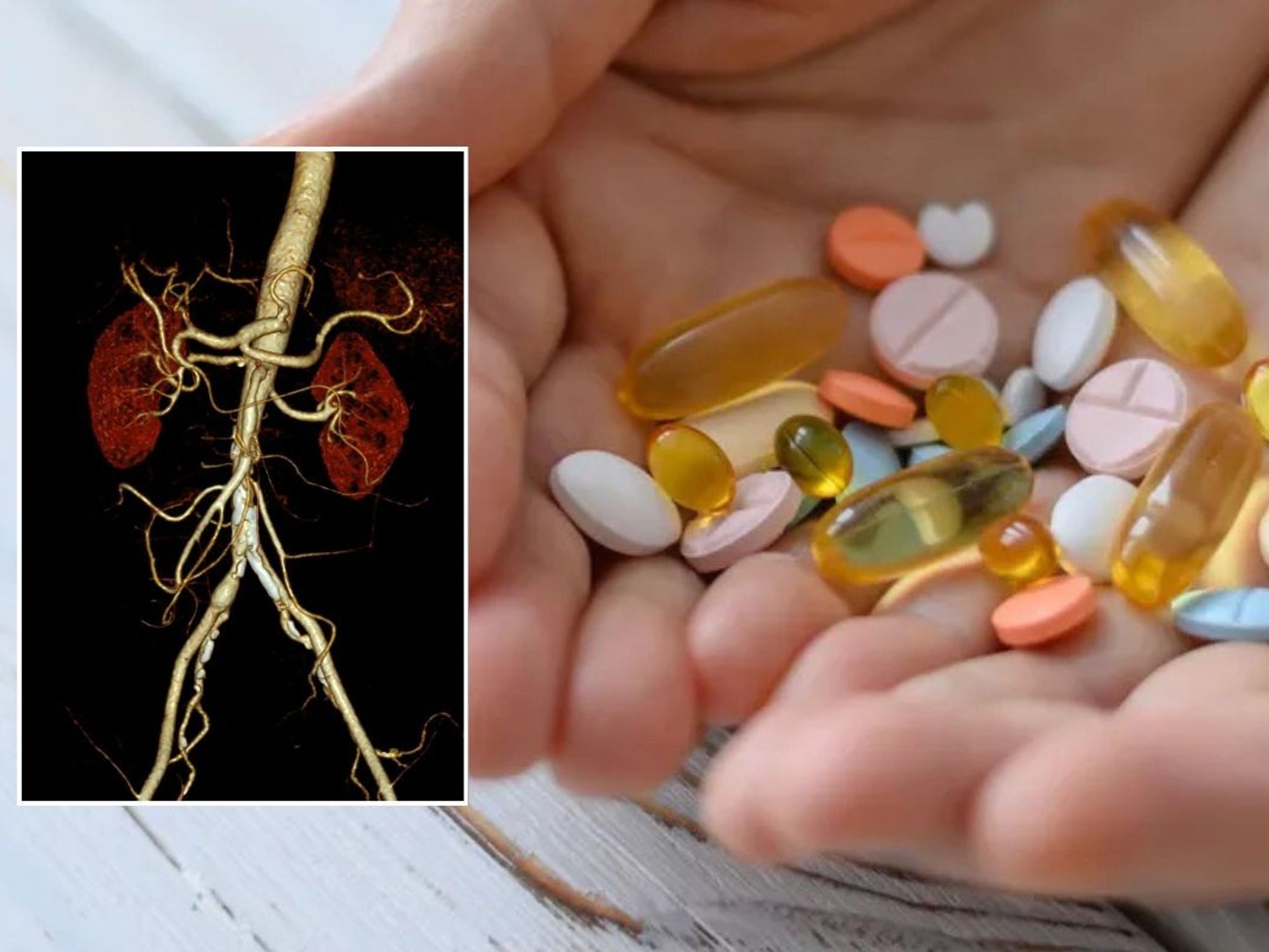 vitamin d supplements