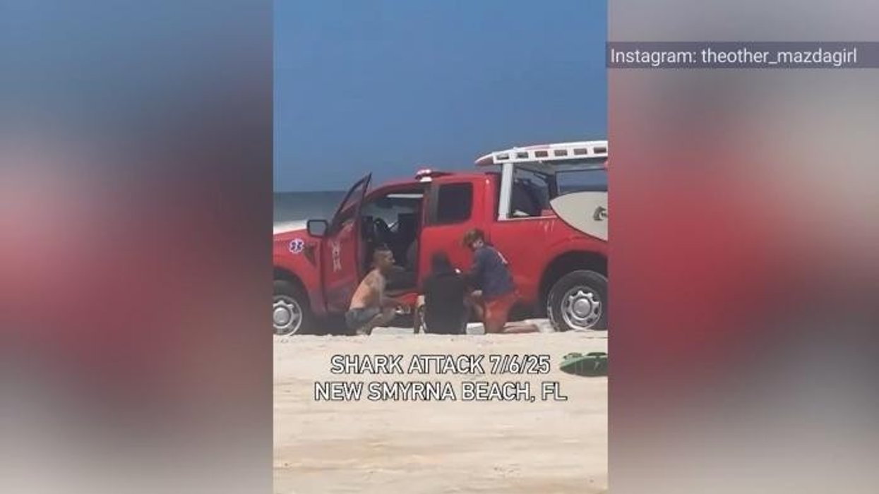 Shark latched on 'like a bear trap' on surfer's hand in world's bite capital