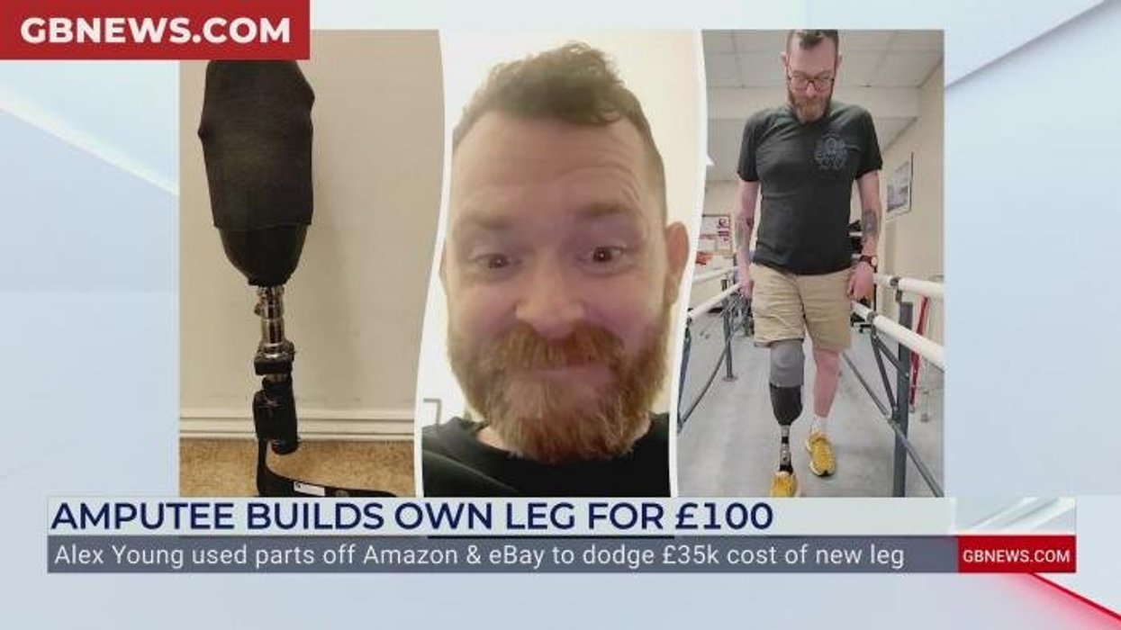 Amputee saves £35,000 by building his own prosthetic leg using parts bought online