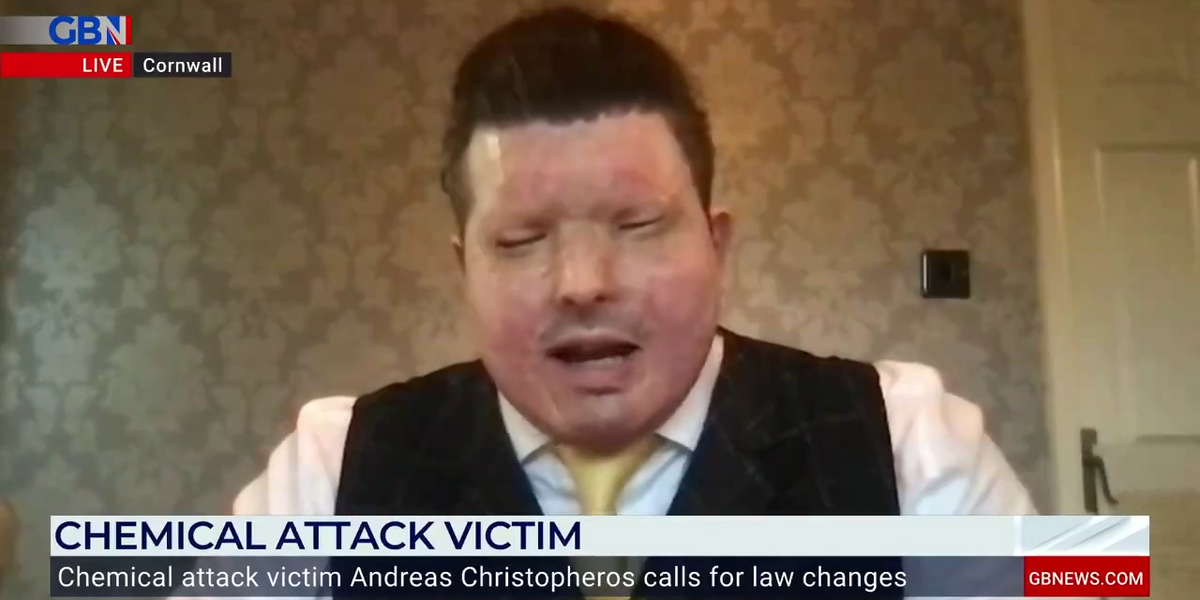 NextImg:Acid attack victim demands tougher sentences as perpetrator deemed ‘not dangerous’