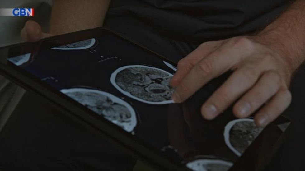 Dementia: Brew 'strong in health benefits' may slash risk of brain decline by 25%