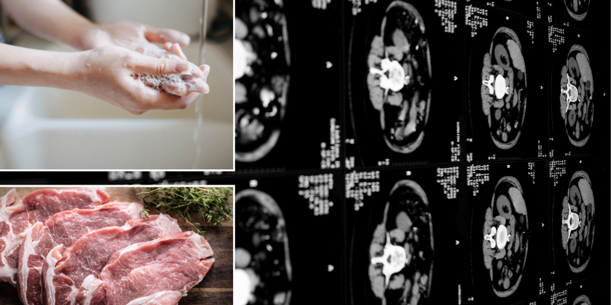 NextImg:Horror X-ray reveals man's body INFESTED with hundreds of breeding creatures after common kitchen mistake