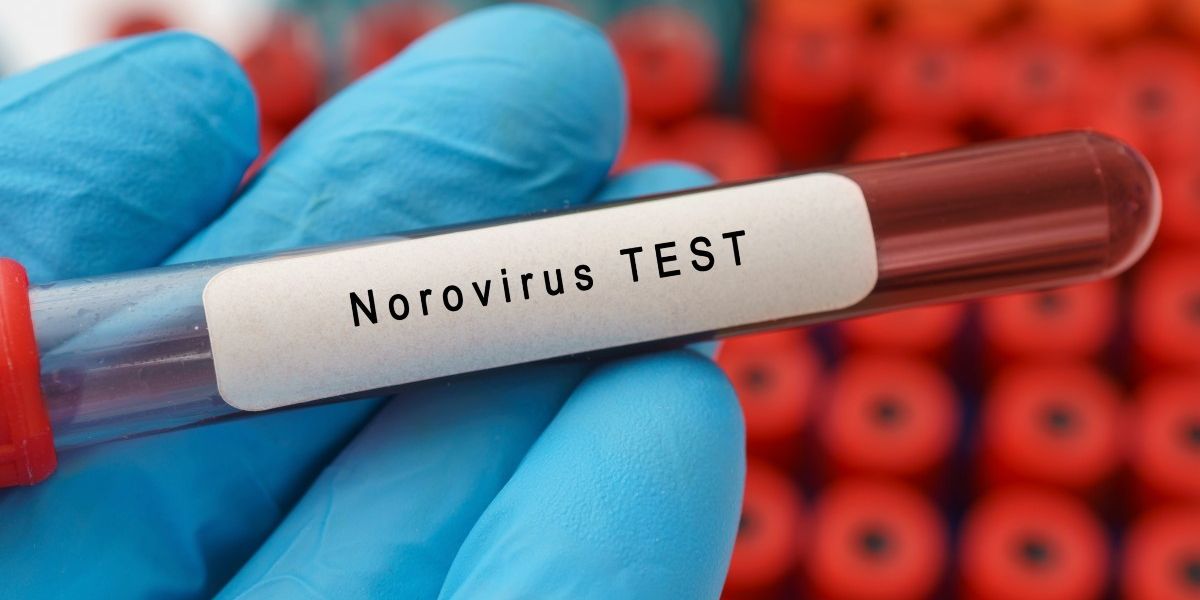 NextImg:Norovirus warning: Britons urged to 'isolate for two days' as hospitalisations surge after winter bug outbreak