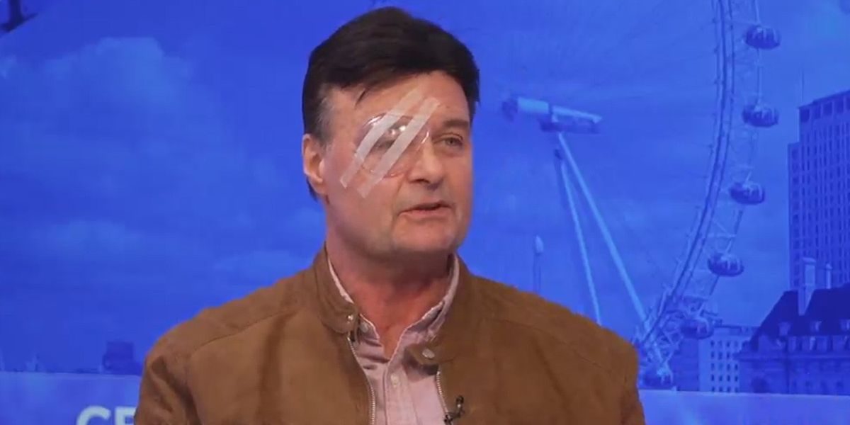 NextImg:West End actor left blind in one eye details horrific attack after being ‘let down’ by authorities: ‘They haven’t done right by me’