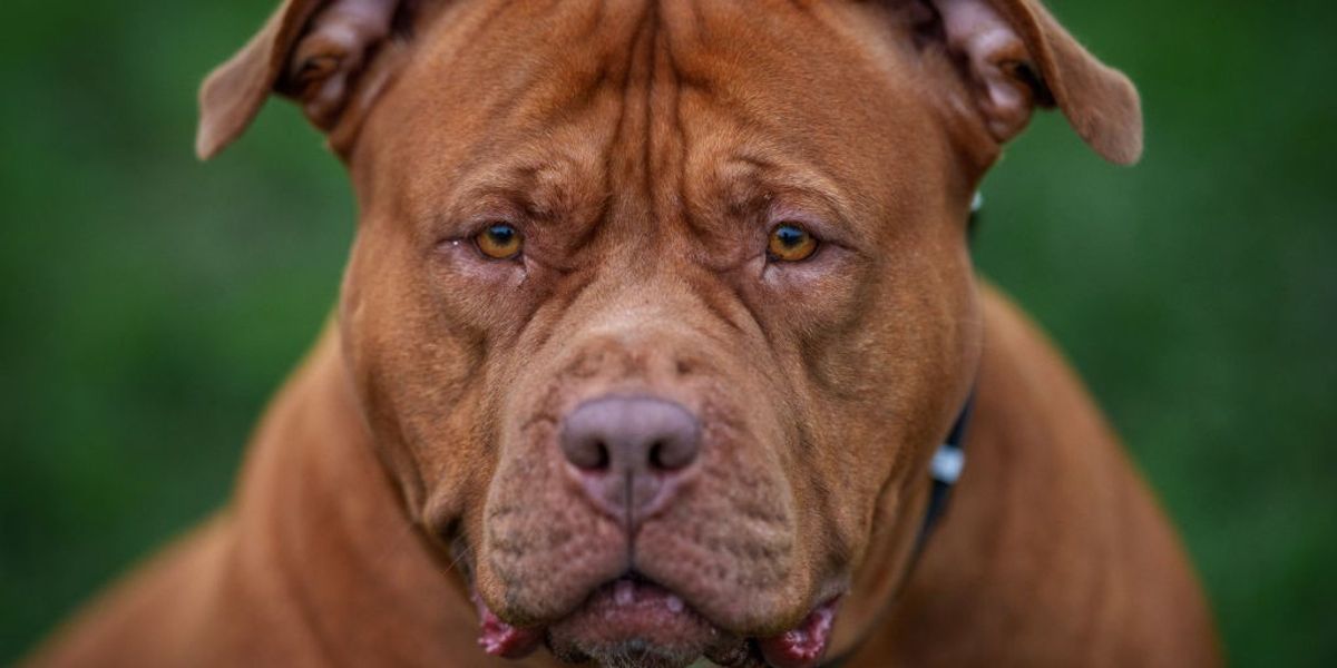 NextImg:Toddler, 3, in need of facial SURGERY after getting mauled by family's XL Bully when it tried to climb on dog