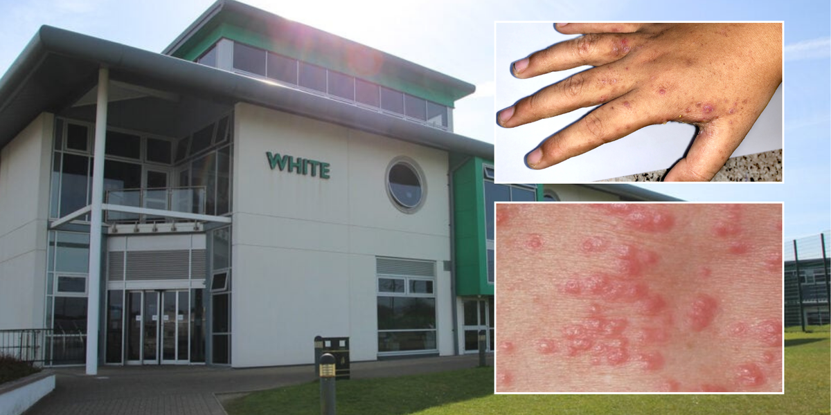 NextImg:Health warning issued after outbreak of Victorian disease in UK schools