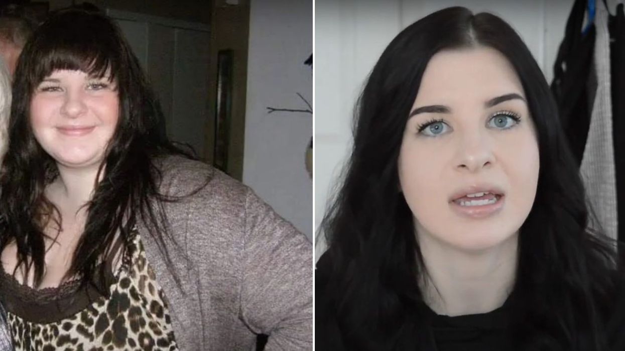 weight loss before and after pics