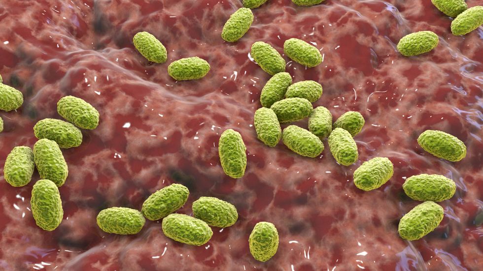 Whooping cough infection