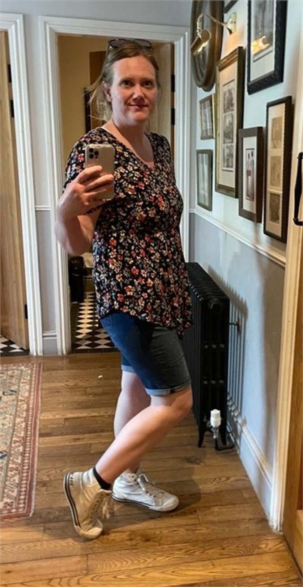 Woman after weight loss