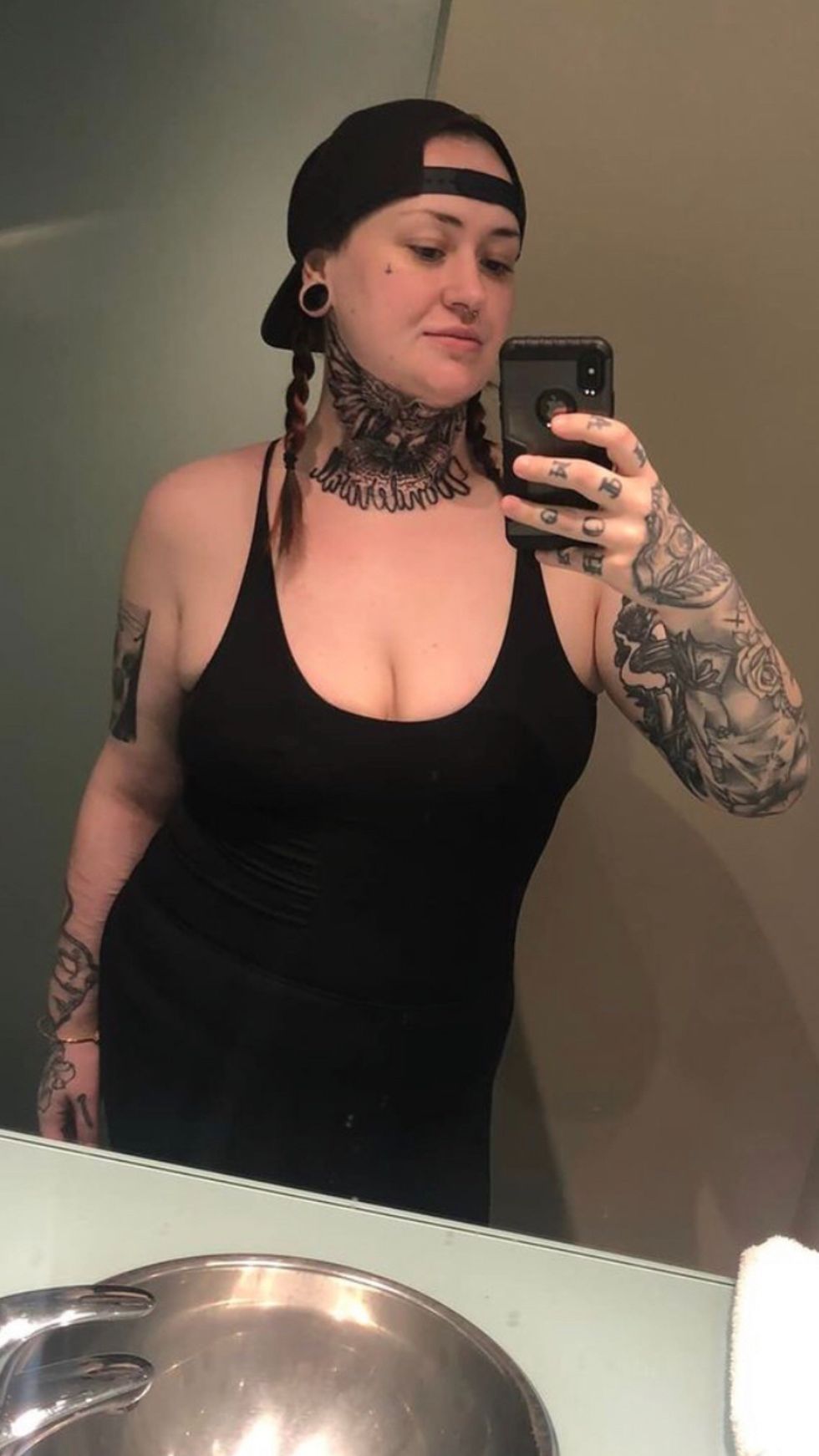 Woman after weight loss