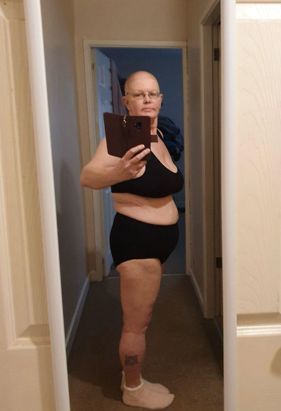 Woman after weight loss