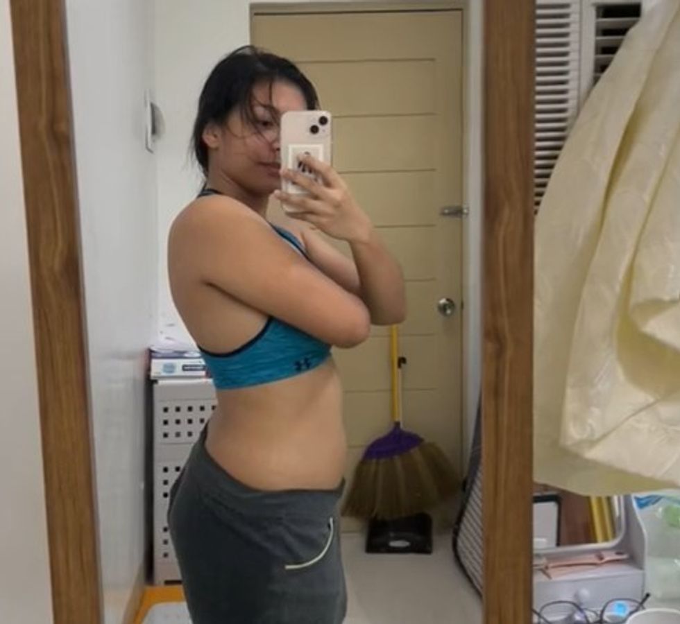 Woman after weight loss