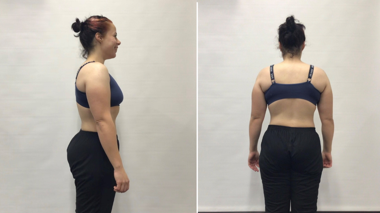 Woman after weight loss