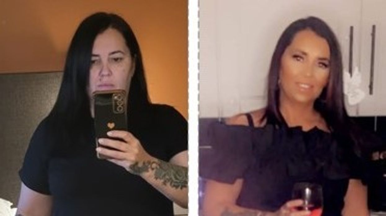 Woman before after weight loss wearing black