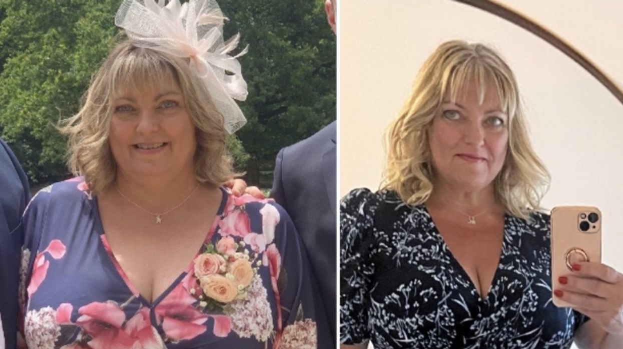 Woman before after weight loss