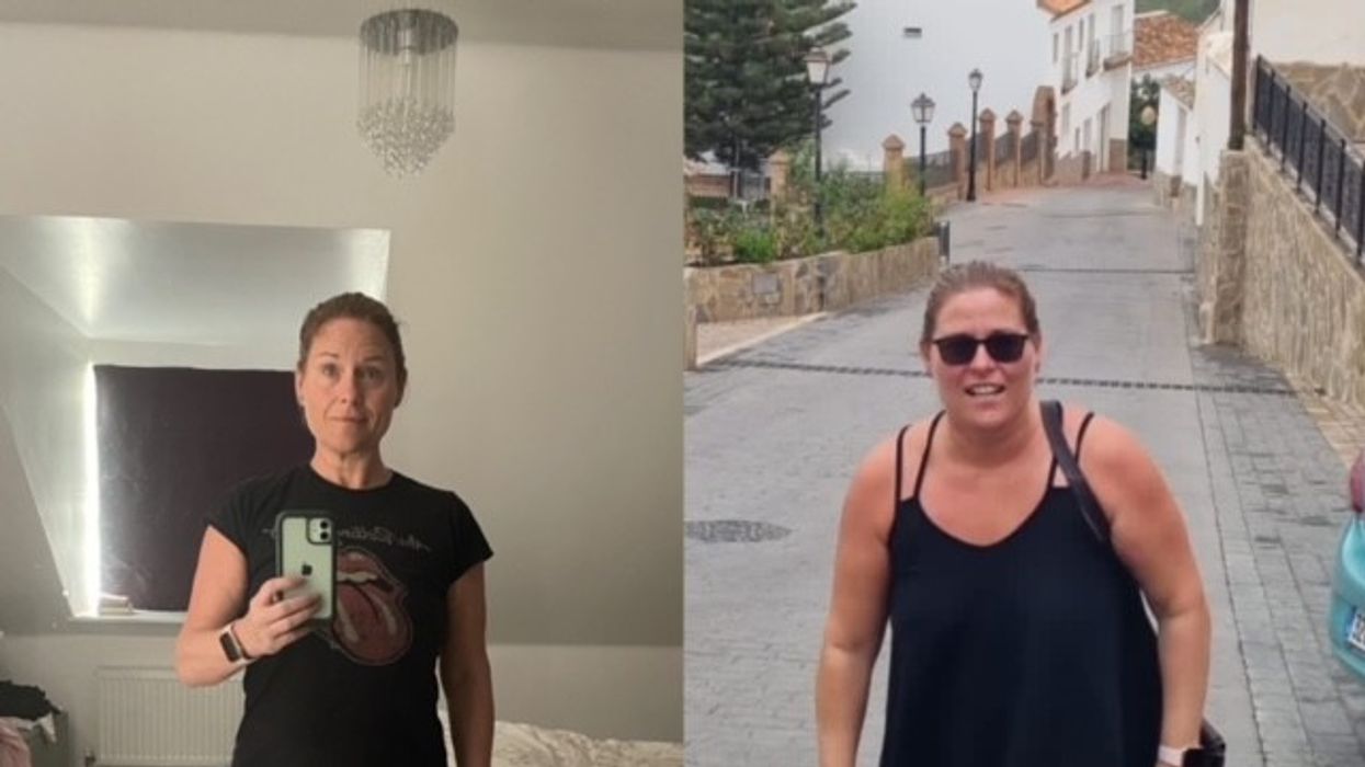 Woman before after weight loss