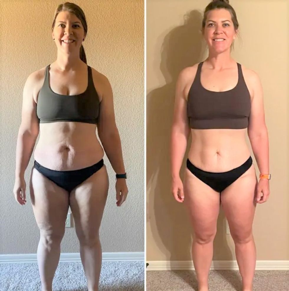 Woman before/after weight loss