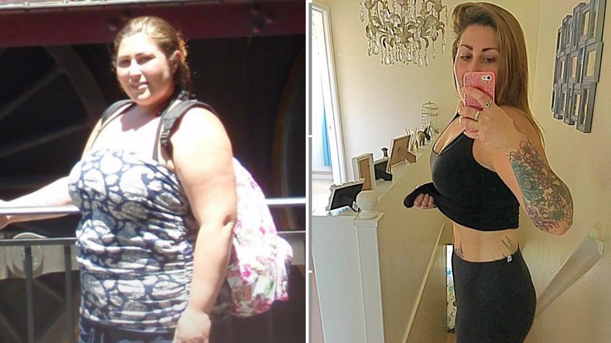 Woman before after weight loss