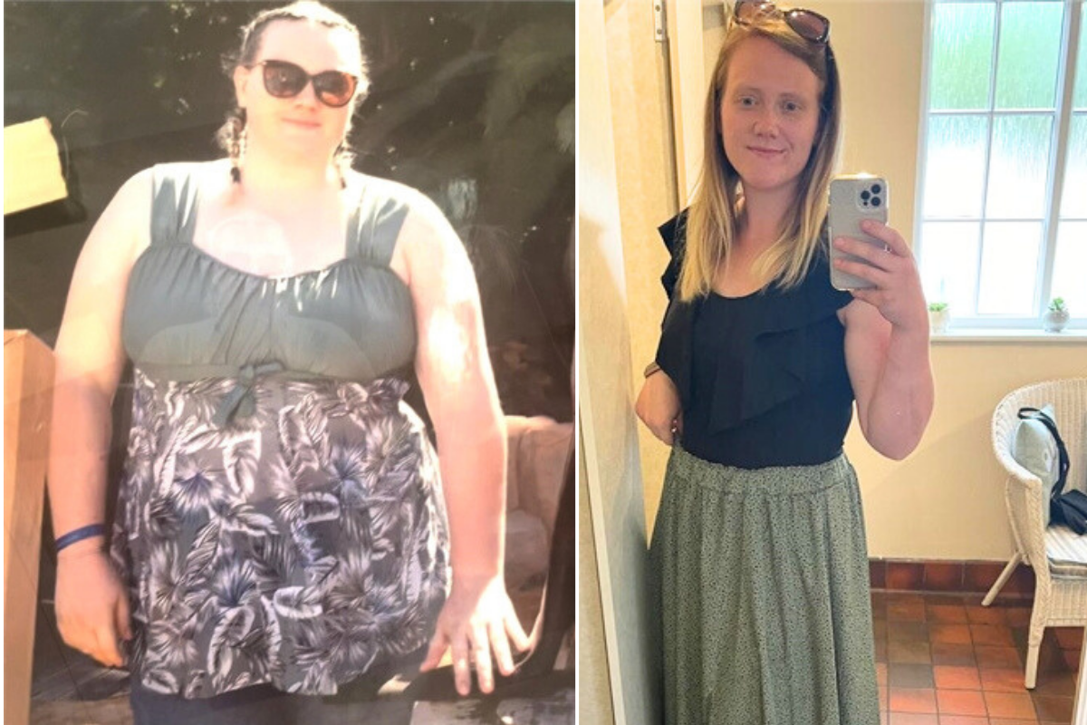 Woman before after weight loss 