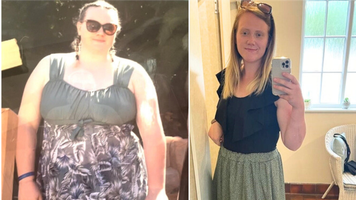 Woman before after weight loss