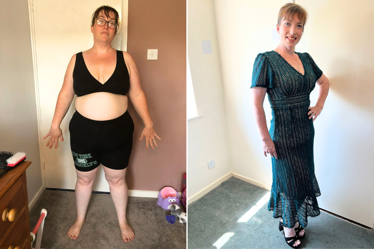 Woman before after weight loss