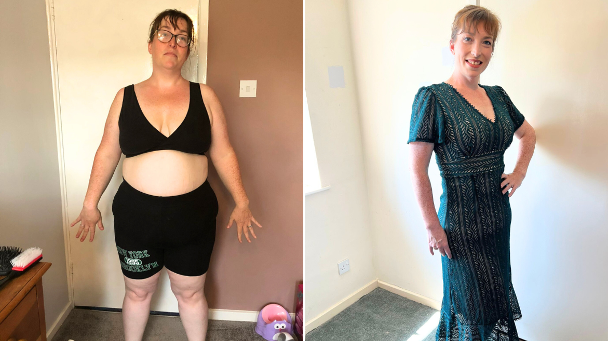 Woman before after weight loss