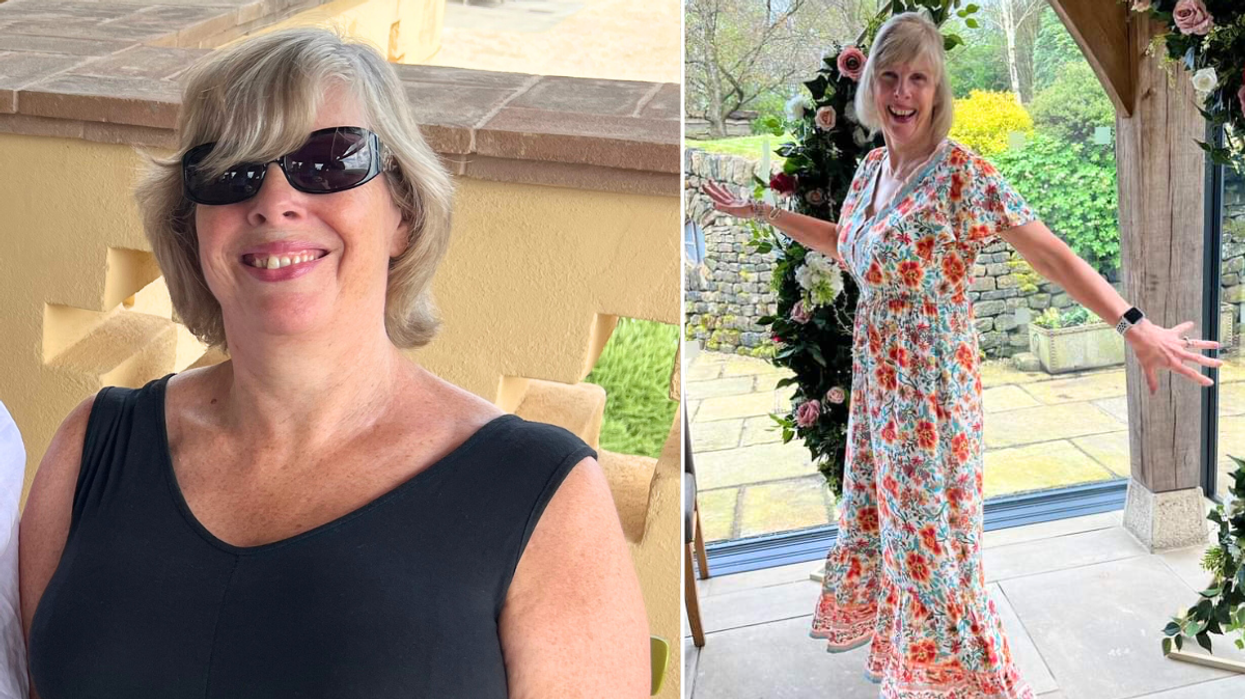 Woman before after weight loss