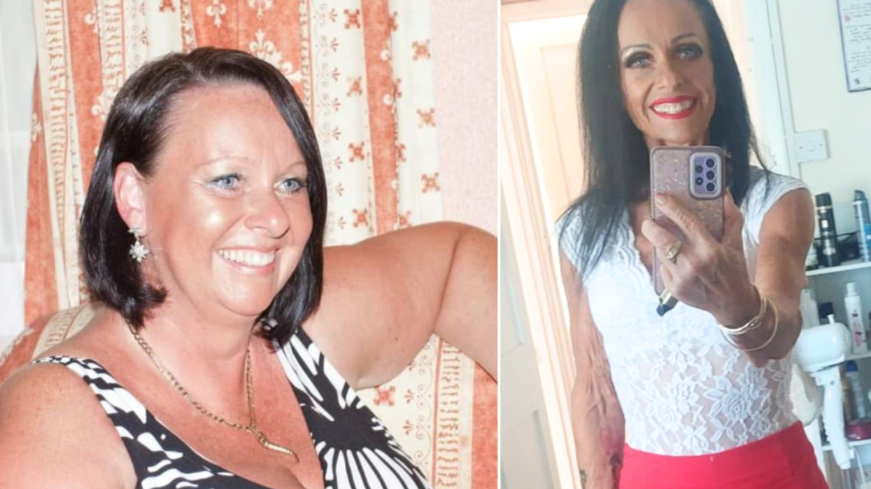 Woman before after weight loss