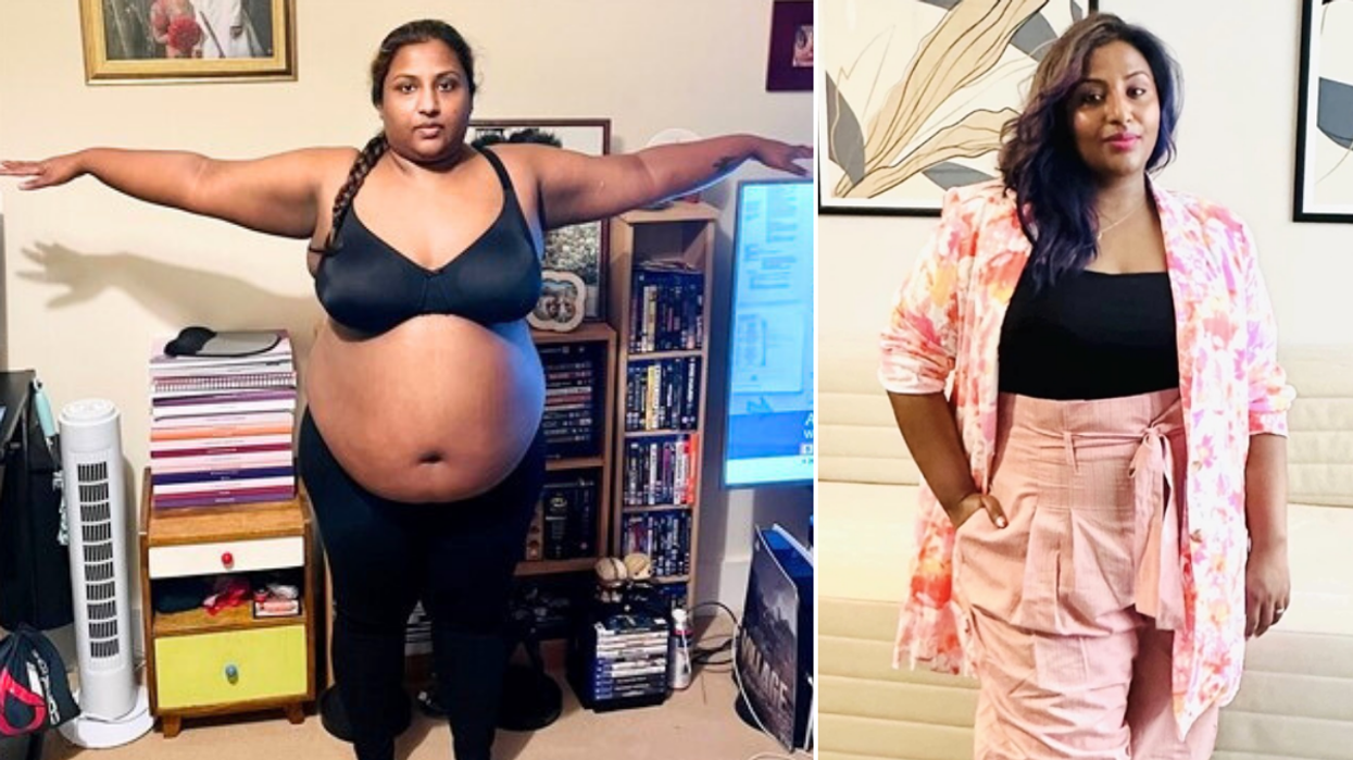 Woman before after weight loss