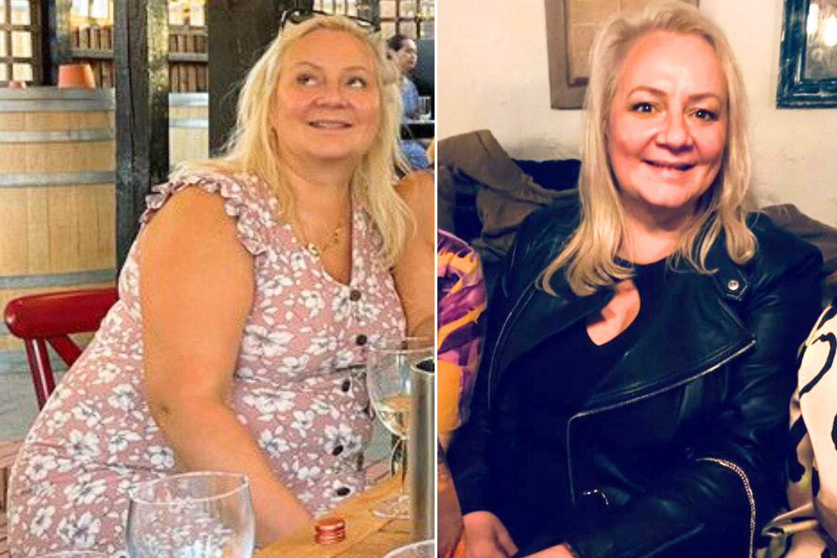 Woman before after weight loss