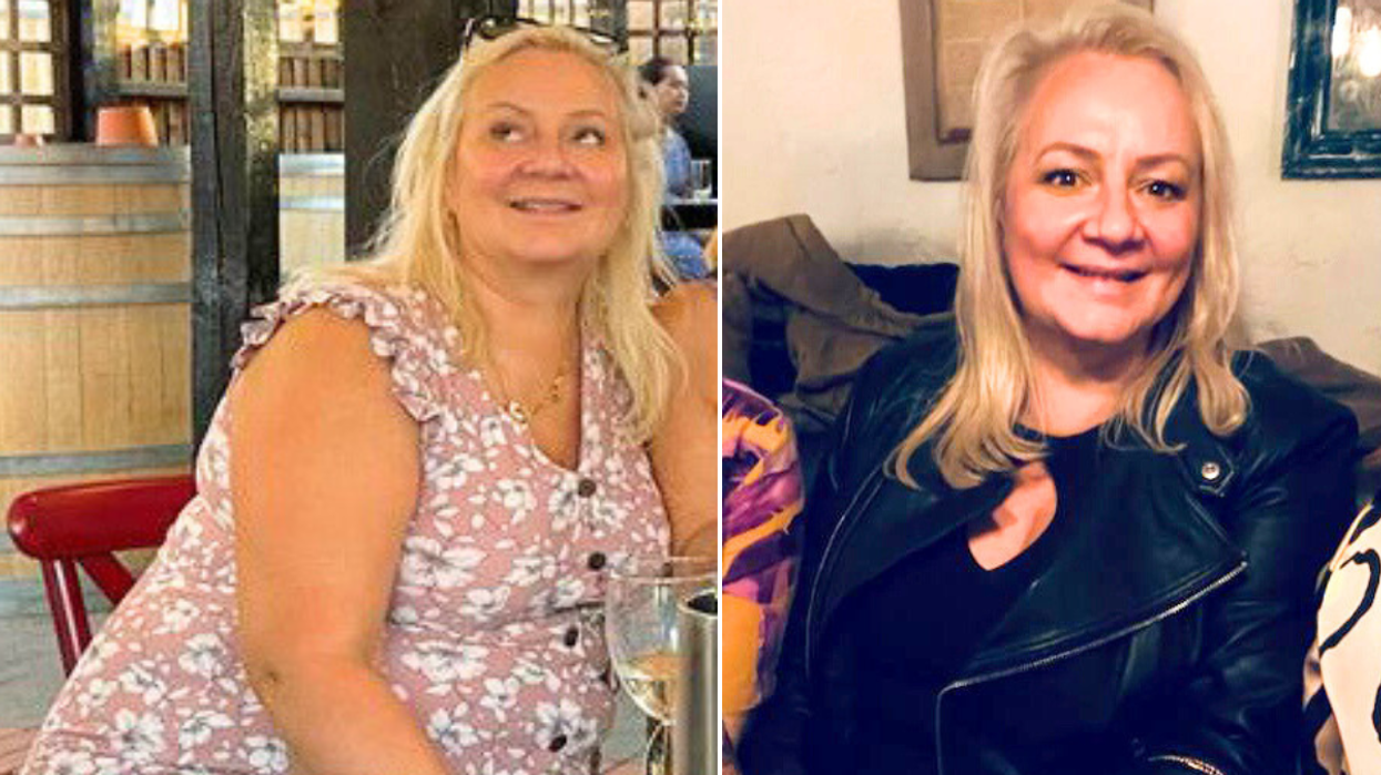Woman before after weight loss