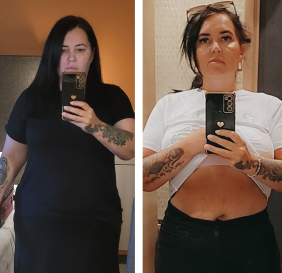 Woman before after weight loss