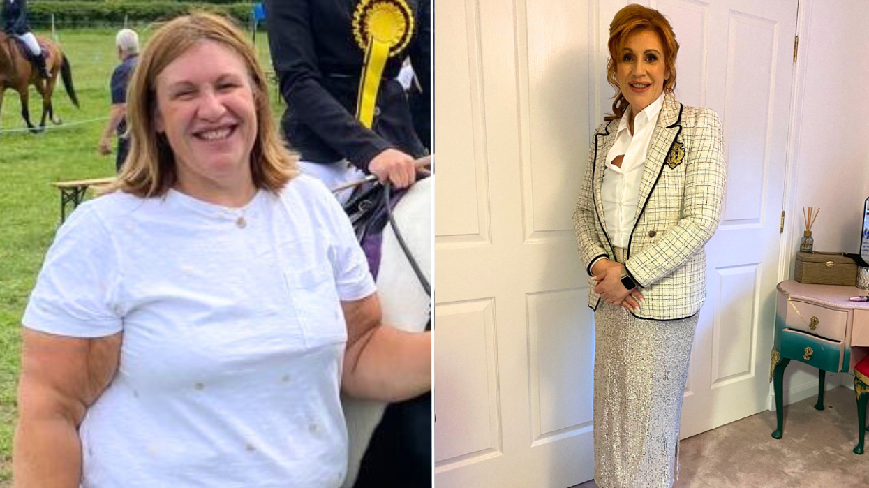 Woman before after weight loss