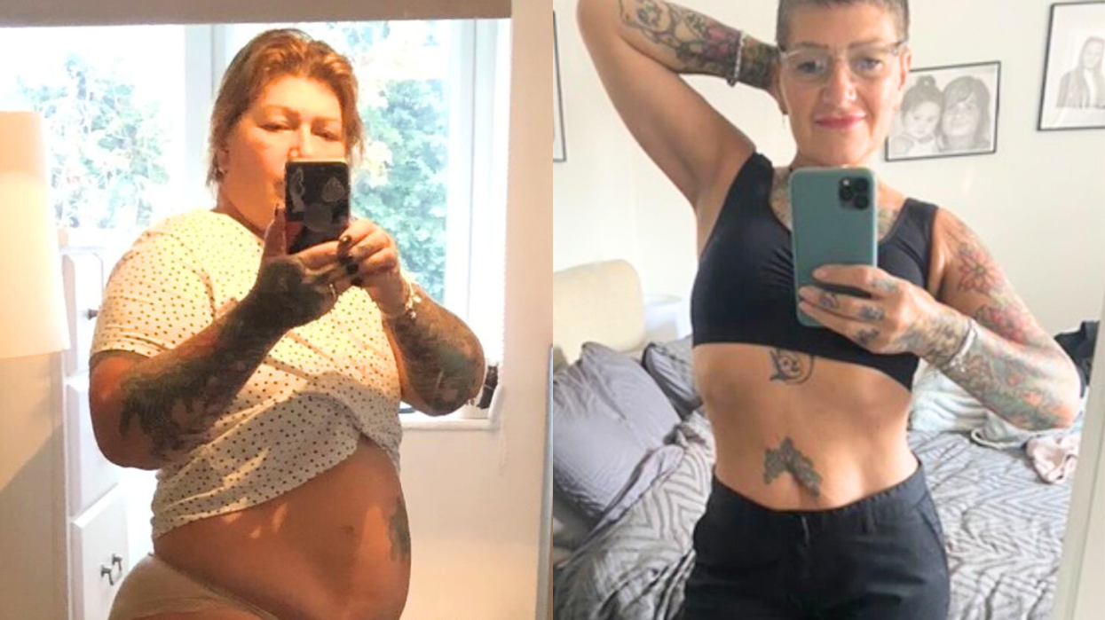 Woman before/ after weight loss